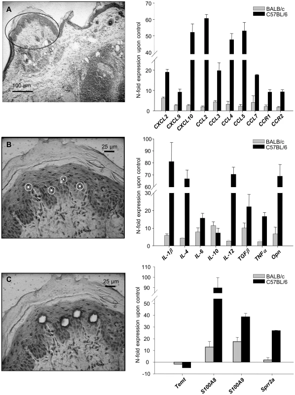 Analysis of gene in keratinocytes isolated from <i>L. major</i> infected skin.