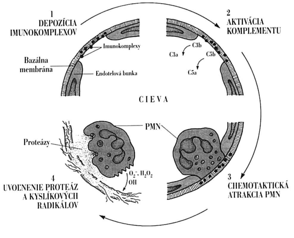 Lokálne imunopatologické pôsobenie imunokomplexov Imunokomplexy na pevne uchytia v bazálnej membráne ciev (1). Následne aktivujú komplementový systém, pričom vznikajú chemotaktické fragmenty, najmä C5a (2), ktoré do miesta uloženia imunokomplexov pritiahnu neutrofily (3). Tieto svojimi Fc-receptormi pre IgG sa snažia imunokomplexy pohltiť, čo sa im pre ich pevné ukotvenie nedarí. Aktivované neutrofily však uvoľňujú svoje cytotoxické látky, ktoré poškodia endotel (4) s následnou aktiváciou hemokoagulačného systému, tvorbou mikrotrombov a ischemickou nekrózou tkaniva. C3a, C3b, C5a, C5b – fragmenty komplementu vznikajúce pri jeho aktivácii; PMN – polymorfonukleárny leukocyt
Fig. 7. Local immunopathological activity of immune complexes Immune complexes deposit in the vascular basal membrane (1). Subsequently, they activate the complement system, with the generation of chemotactic fragments, in particular C5a (2), that direct neutrophils towards the immune complexes (3). Neutrophils try to phagocytize the immune complexes via the IgG Fc-receptors but are not successful due to the firm adhesion of the immune complexes. Activated neutrophils release cytotoxic substances causing damage to the endothelium (4) with subsequent activation of the blood coagulation system, microthrombus formation and ischemic tissue necrosis. C3a, C3b, C5a, C5b – complement fragments generated during the complement activation; PMN – polymorphonuclear leukocyte