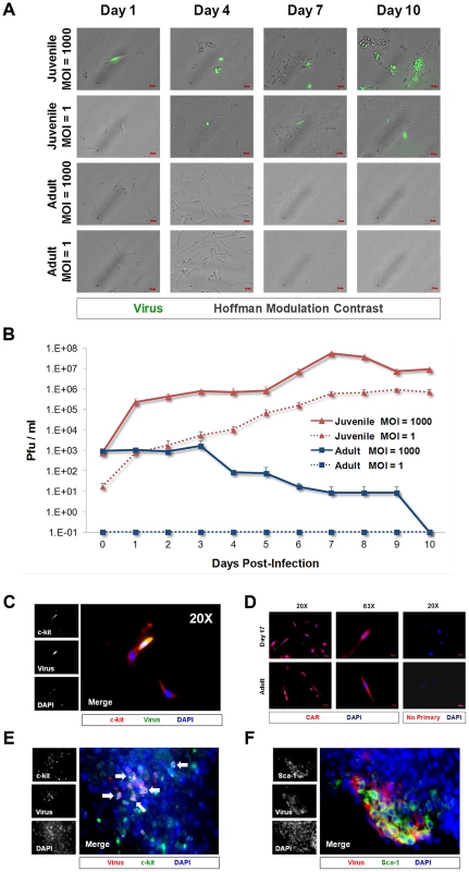 CVB3 productively infected juvenile cardiac-derived c-kit+ cells grown in culture and in the juvenile heart.