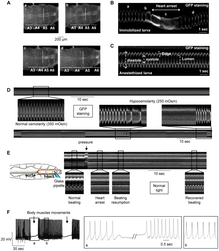 Mechanosensitive response of the cardiac tube in control (<i>y</i>,<i>w</i>; <i>CS</i> ×1029-Gal4) larvae.