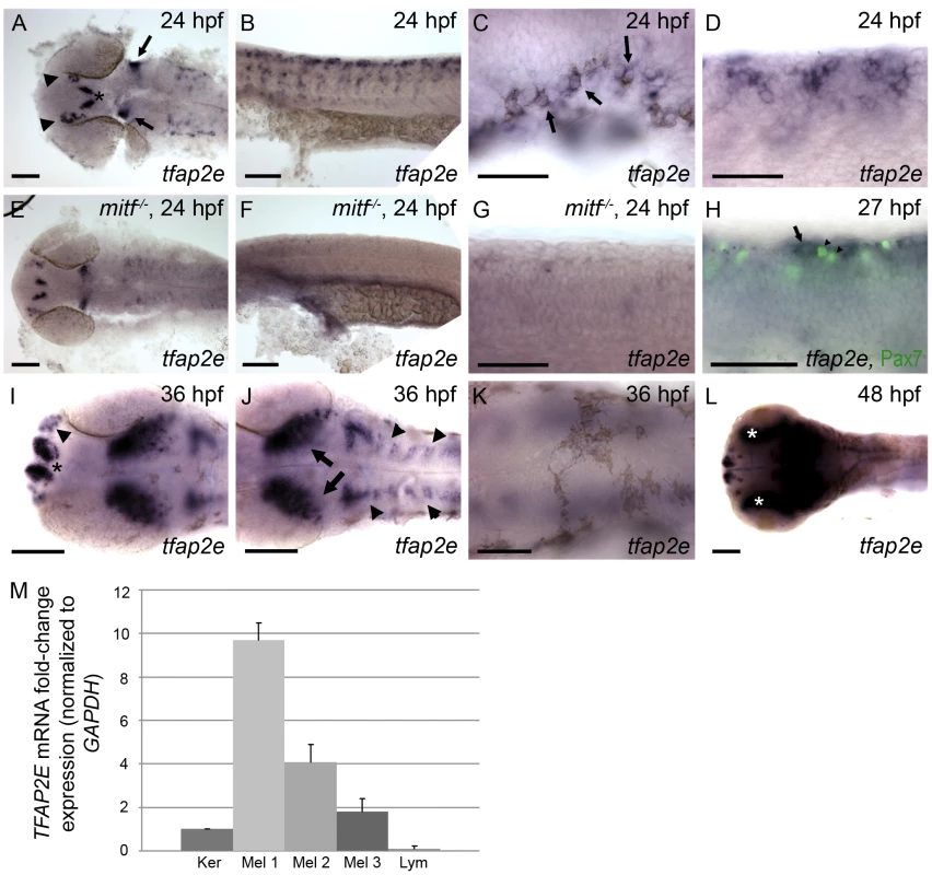 Characterization of <i>tfap2e</i> expression during embryogenesis.