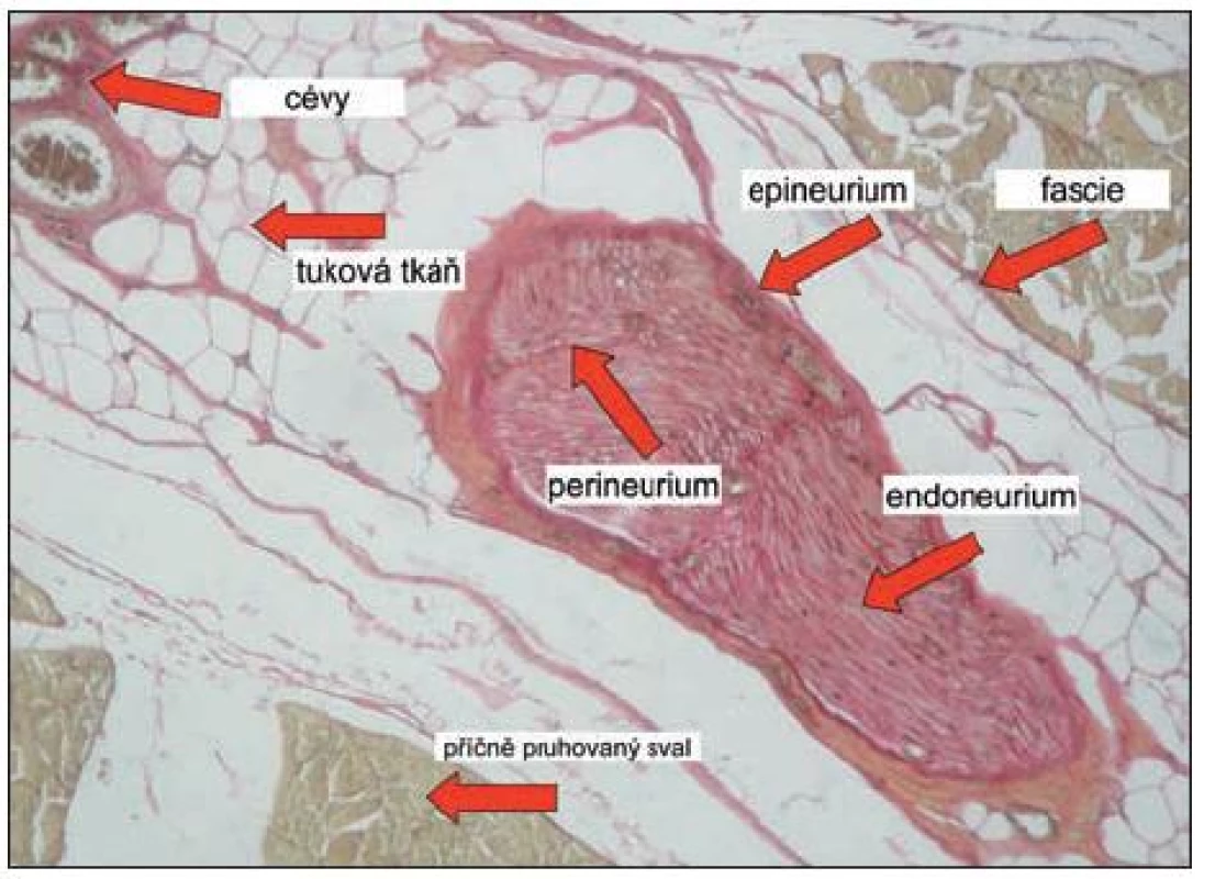 Histologický řez interskalenickým prostorem