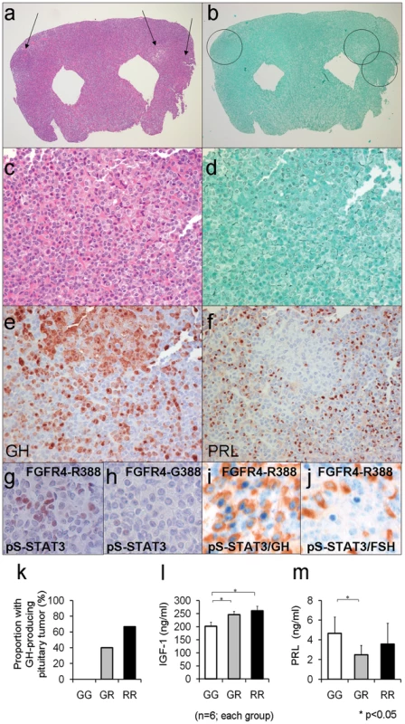 Mouse knock-in of the FGFR4 SNP facilitates pituitary GH cell tumorigenesis.