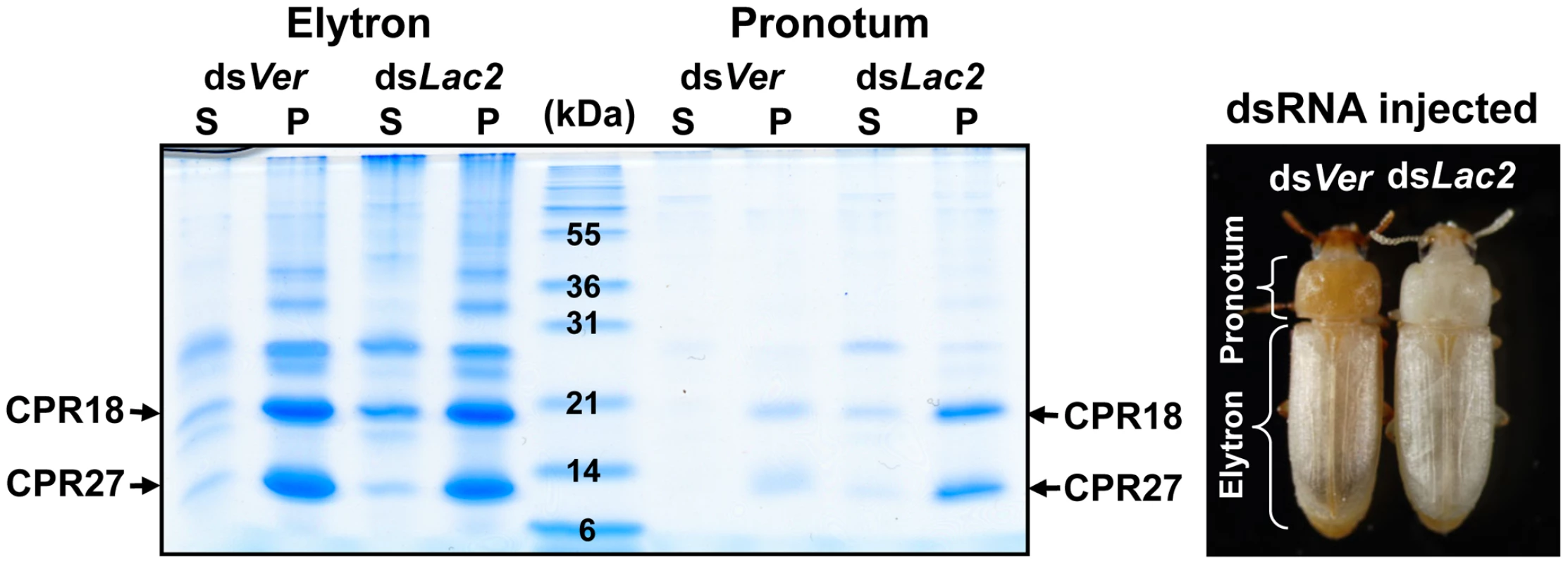 TcCPR27 and TcCPR18 are abundant in cuticle of the pronotum.