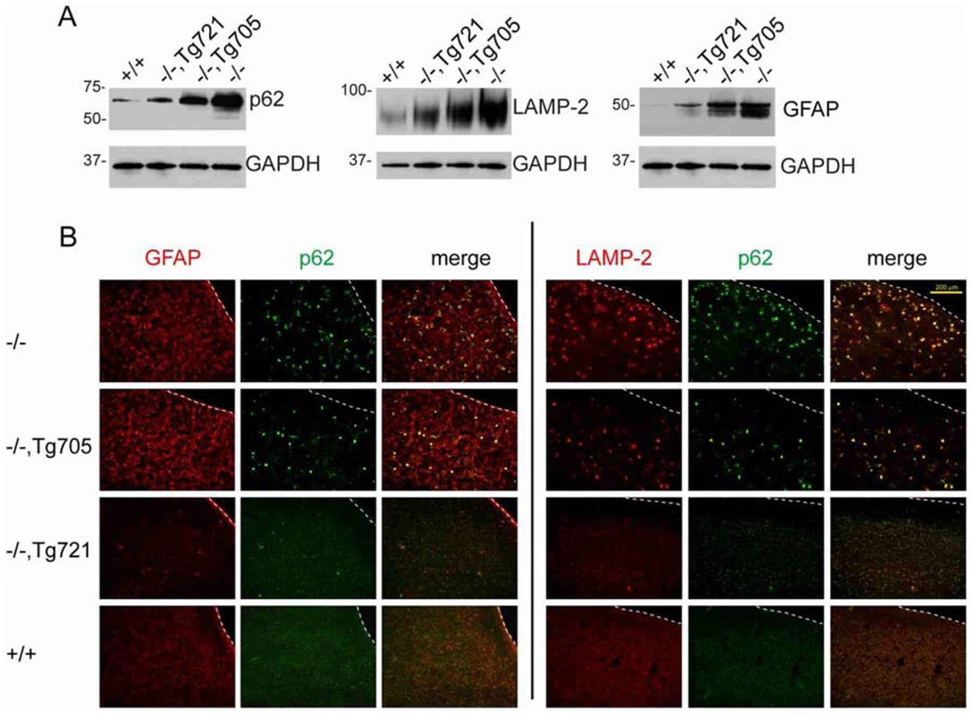 Dose-dependent rescue of the autophagy defect in brain of transgenic mice.