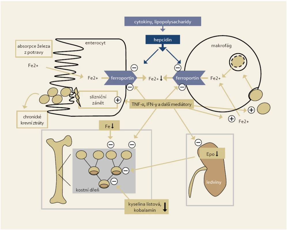 Zjednodušené schéma patofyziologických mechanizmů vedoucích k anémii u IBD pacientů (Weiss a Gasche, 2010).
Fig. 1. Simplified chart of pathophysiological mechanisms leading to anaemia in IBD patients (Weiss and Gasche, 2010).