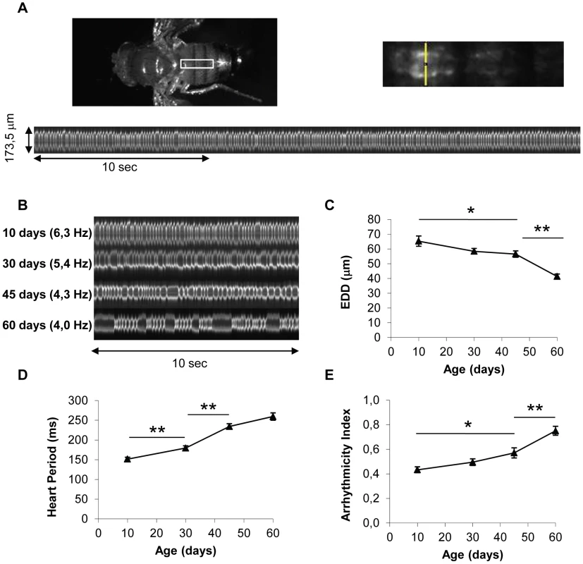 <i>In vivo</i> analysis of cardiac aging.