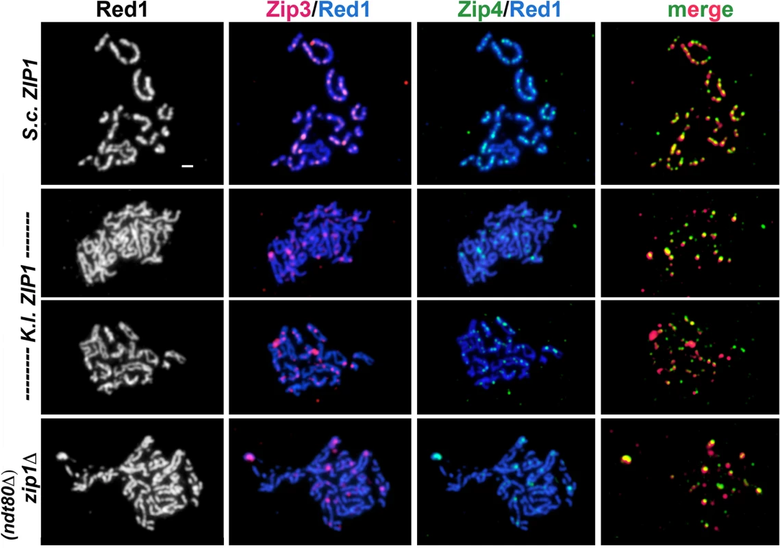 Zip3-MYC and Zip4-HA levels exhibited by <i>K</i>. <i>l</i>. <i>ZIP1</i>-expressing cells resemble <i>zip1</i> null levels.