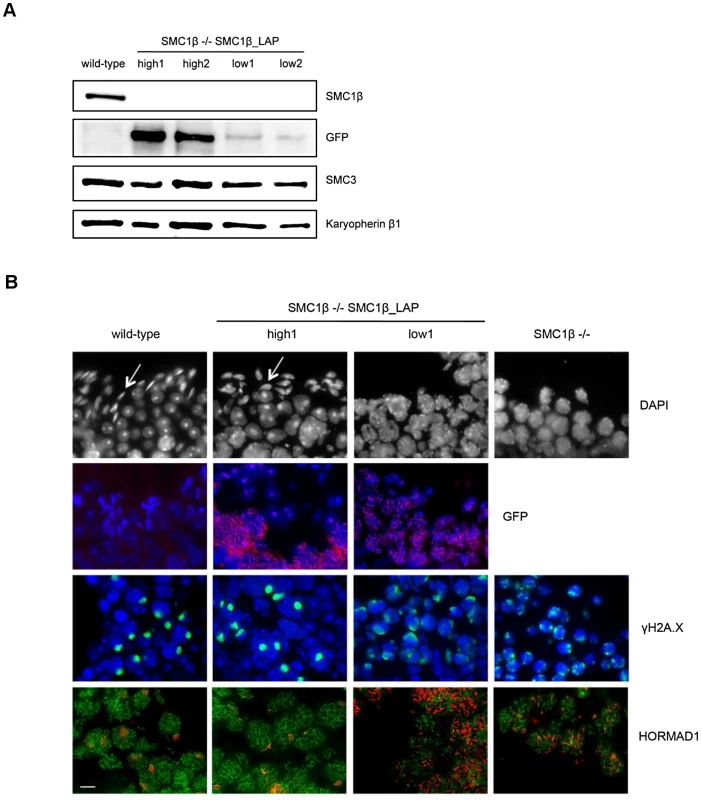 The effect of variable levels of SMC1β-LAP expression during meiosis.