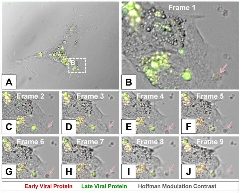 Time lapse photography frames showing microvesicle egress from a Timer-CVB3-infected cell.