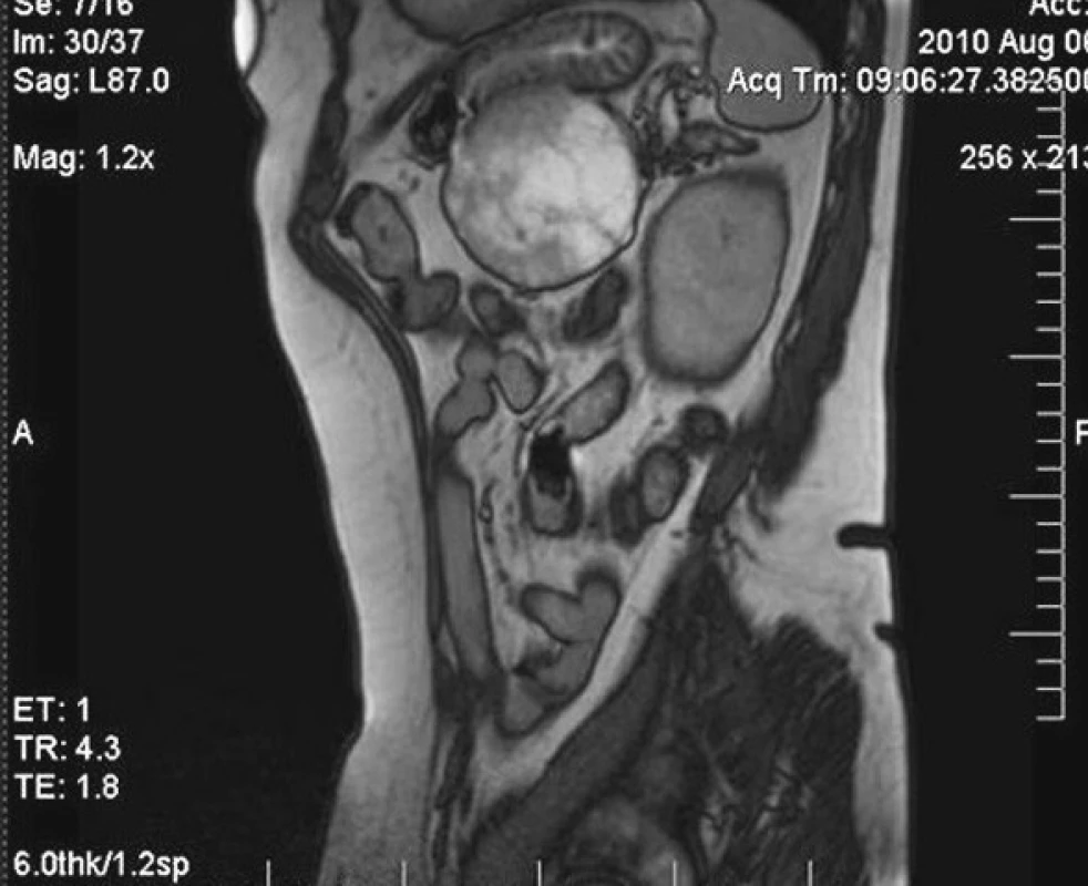 MRI vyšetrenie v sagitálnej rovine
Fig. 7. MRI examination, sagittal view