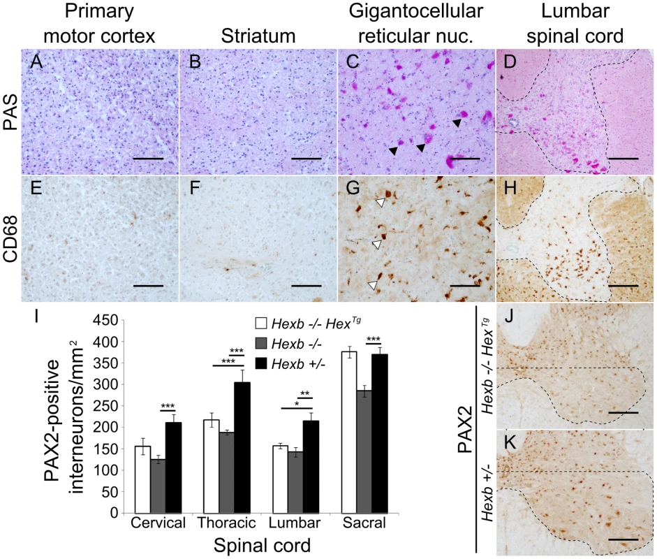 Localized glycolipid storage and microgliosis in <i>Hexb−/−Hex<sup>Tg</sup></i> mice at humane endpoint.