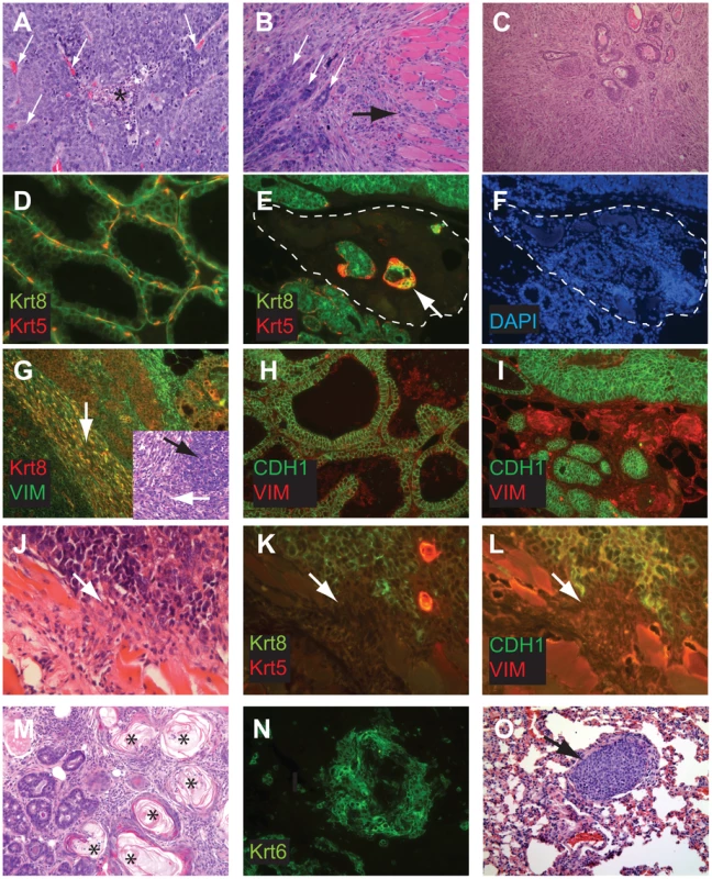 Perturbed differentiation in TBP tumors.