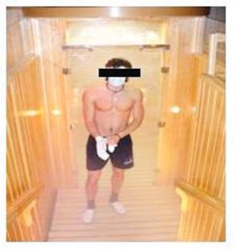 Vstup do kryokomory, při němž je proband vybaven rouškou chránící dýchací cesty před silným mrazem, čelenkou a rukavicemi.