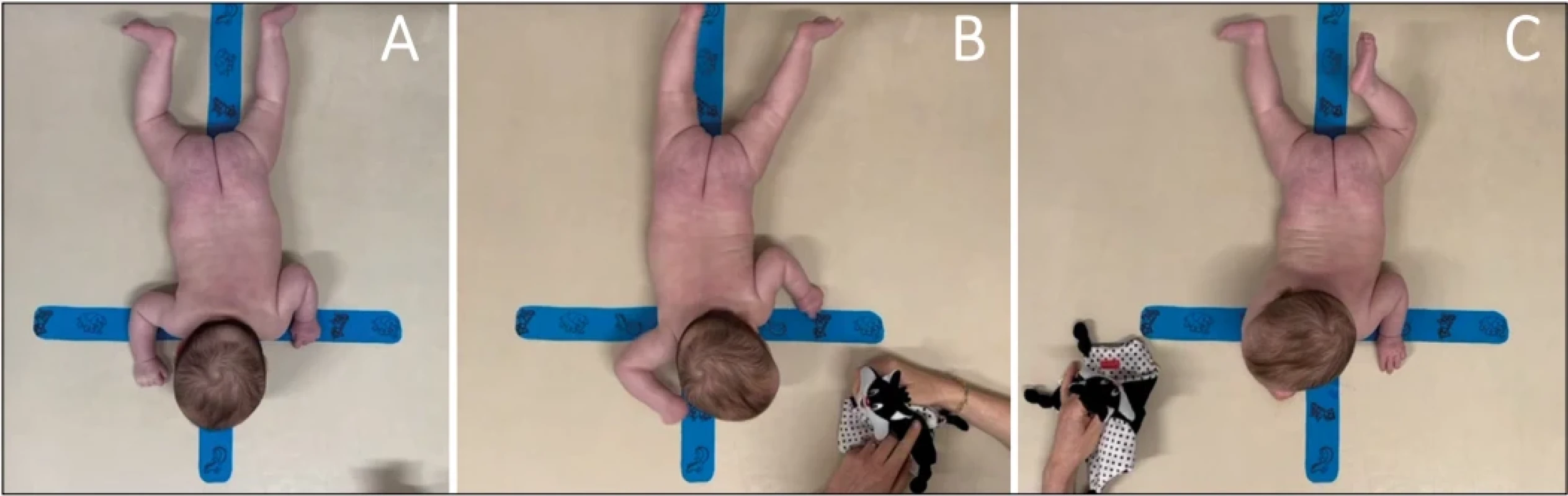 Poloha dítěte na břiše. A: Neutrální, startovací poloha. B: Stimulace z jedné strany. C: Stimulace z druhé strany. Fig. 2. Child in a prone position. A: Neutral starting position. B: Stimulation from one side. C: Stimulation from the other side.