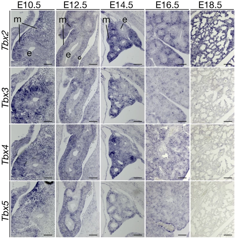 Expression analysis of T-box genes suggests a non-redundant role of <i>Tbx2</i> in late lung development.