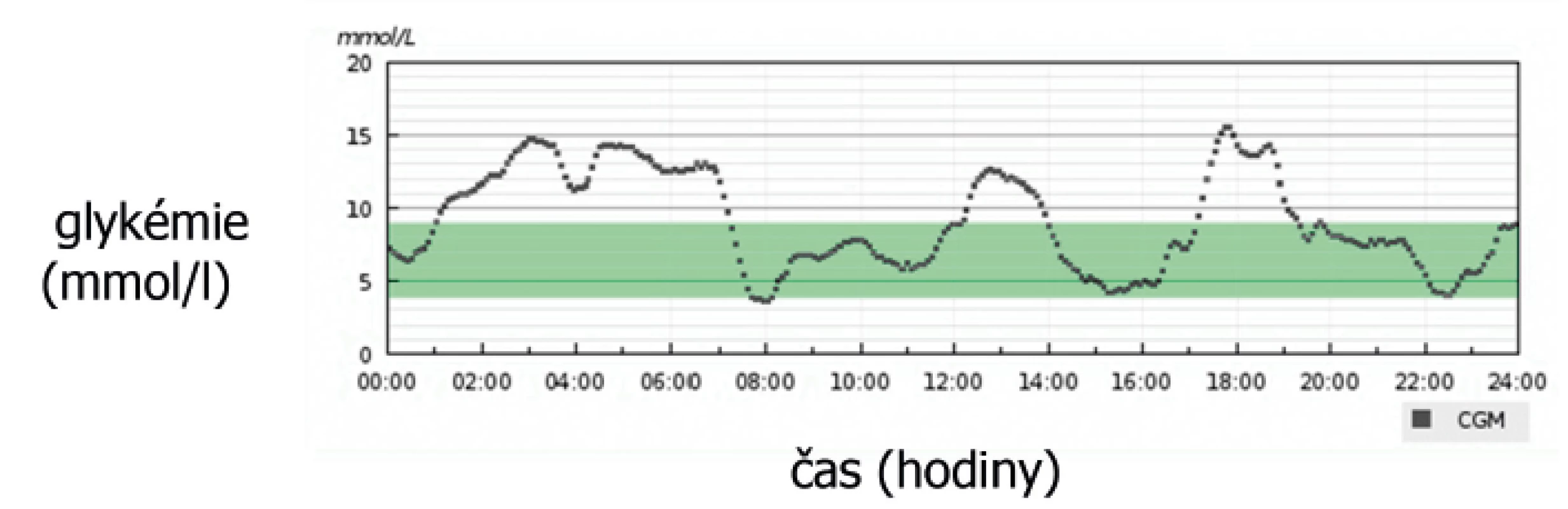 Denní záznam z kontinuálního monitoru glykémie.