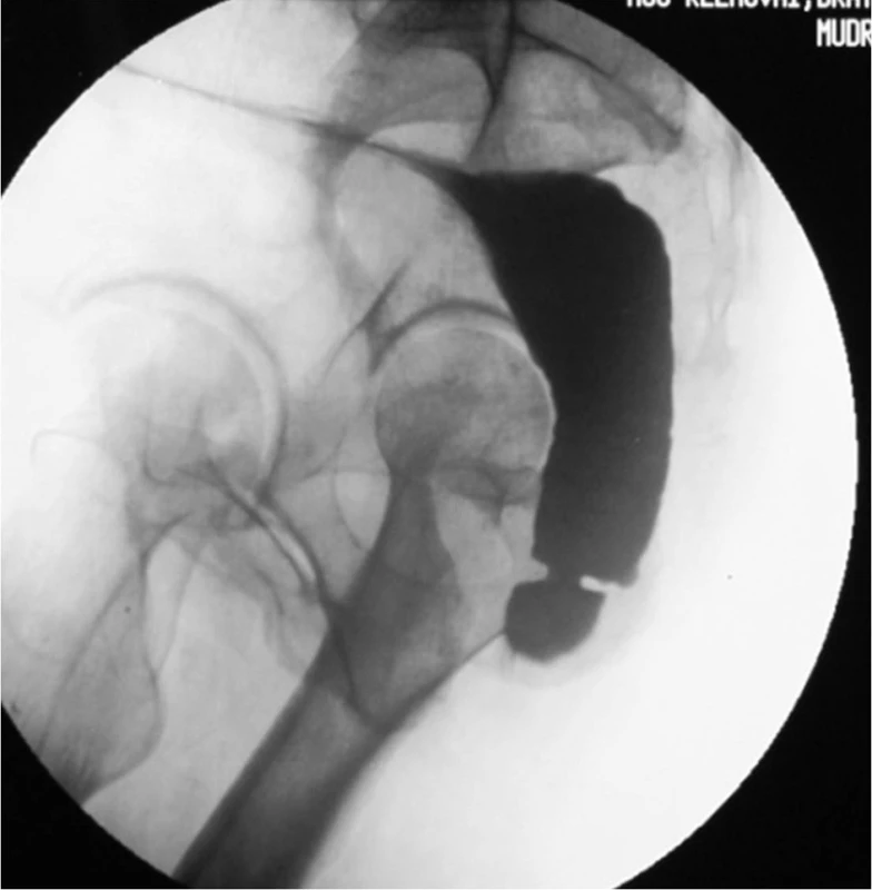 Irigografia
Fig. 2: Irrigography