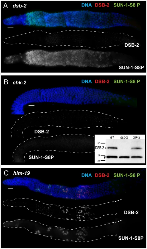 DSB-2 and SUN-1 S8P are coordinately regulated by common upstream regulator CHK-2.