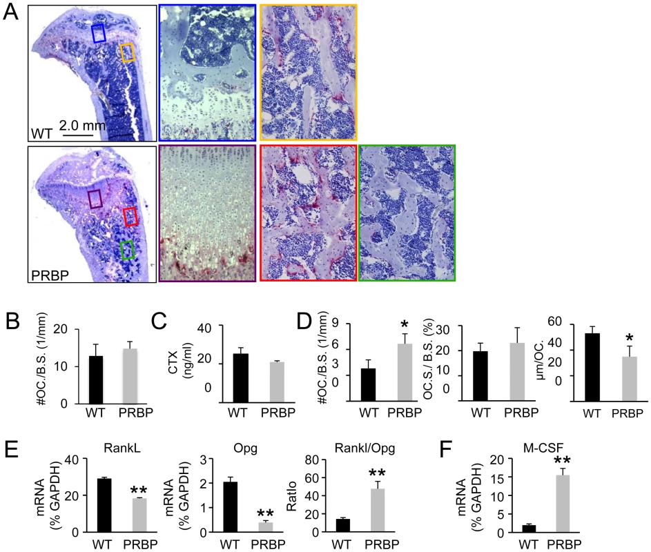 Osteoclasts in PRBP mice at 8 weeks of age.