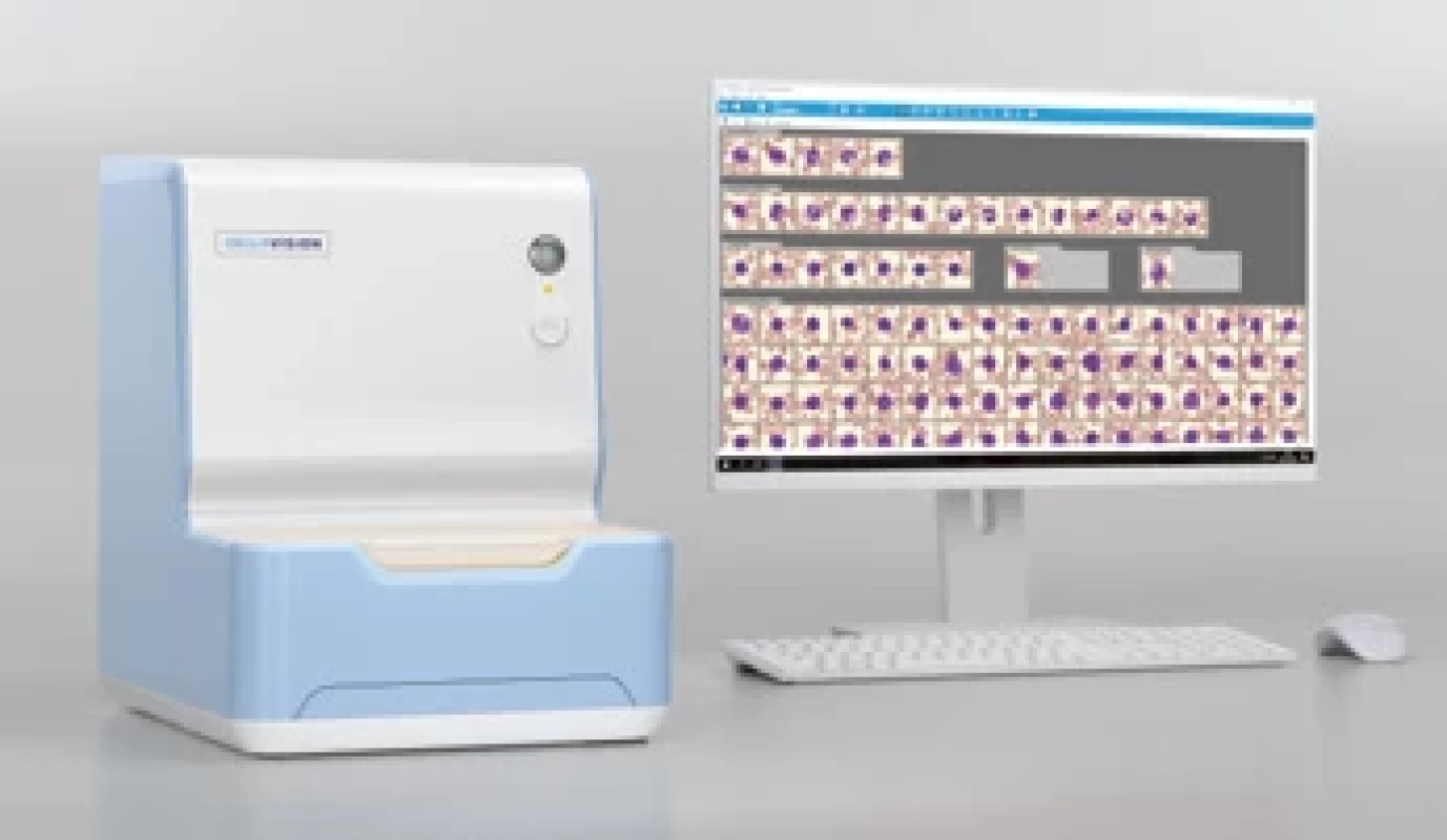Analyzátor CellaVision DC-1 a aplikace CellaVision Peripheral Blood and Body Fluid. S laskavým svolením společnosti CellaVision.