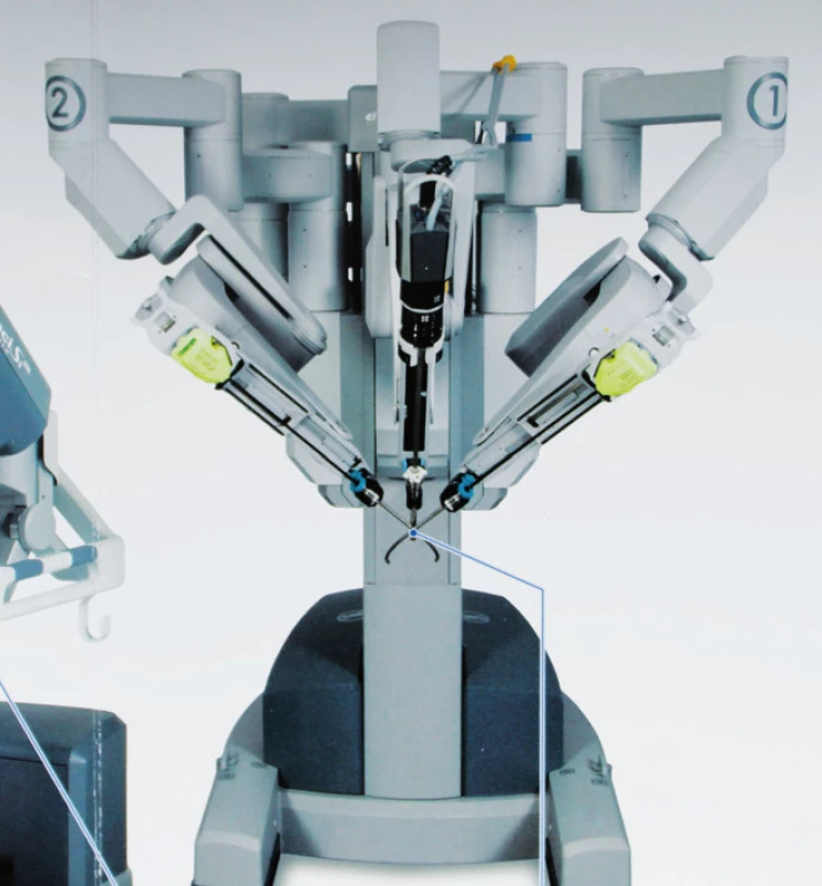 Robotické LEES instrumentárium u systému Da Vinci SI (2012)
Fig. 2. Robotic LESS instrumetarium by system Da Vinci SI (2012)