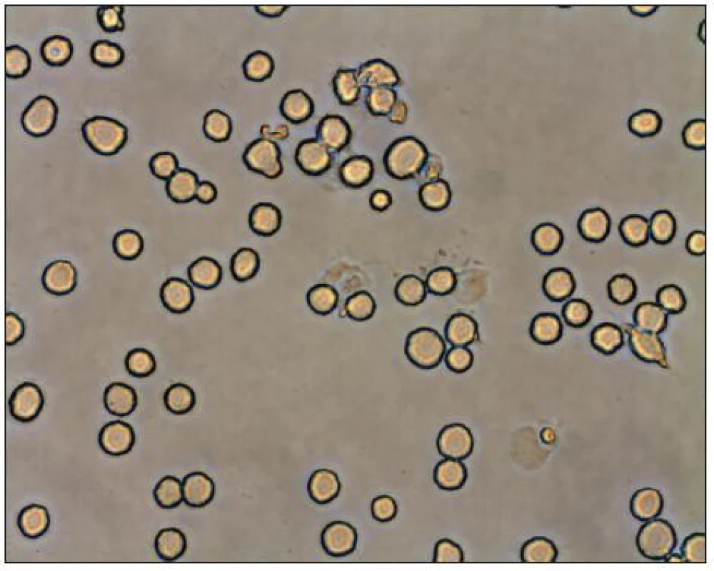 Soubor makrofágů v mikroskopu
Fig. 2. Population of macrophages in a microscope