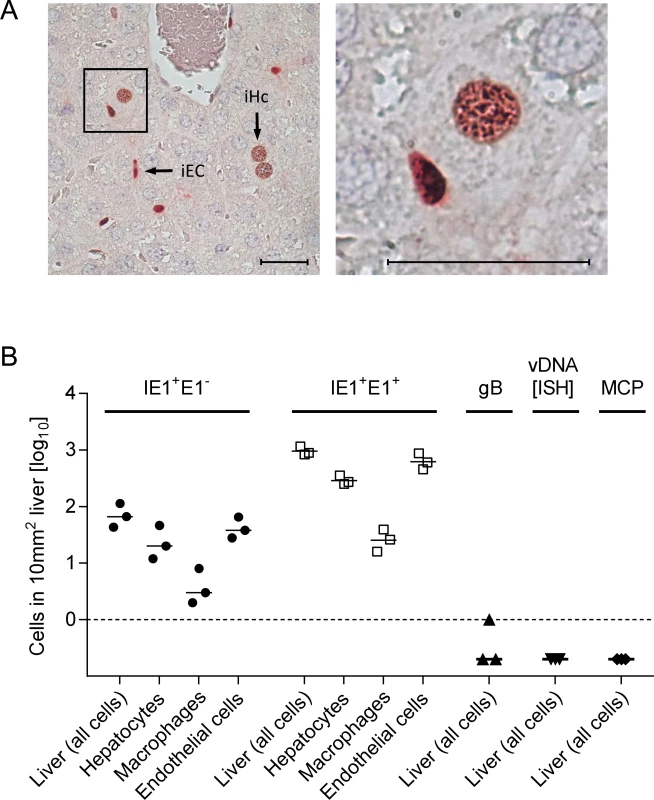 Synchronicity of infection initiation in main cell types of the liver.