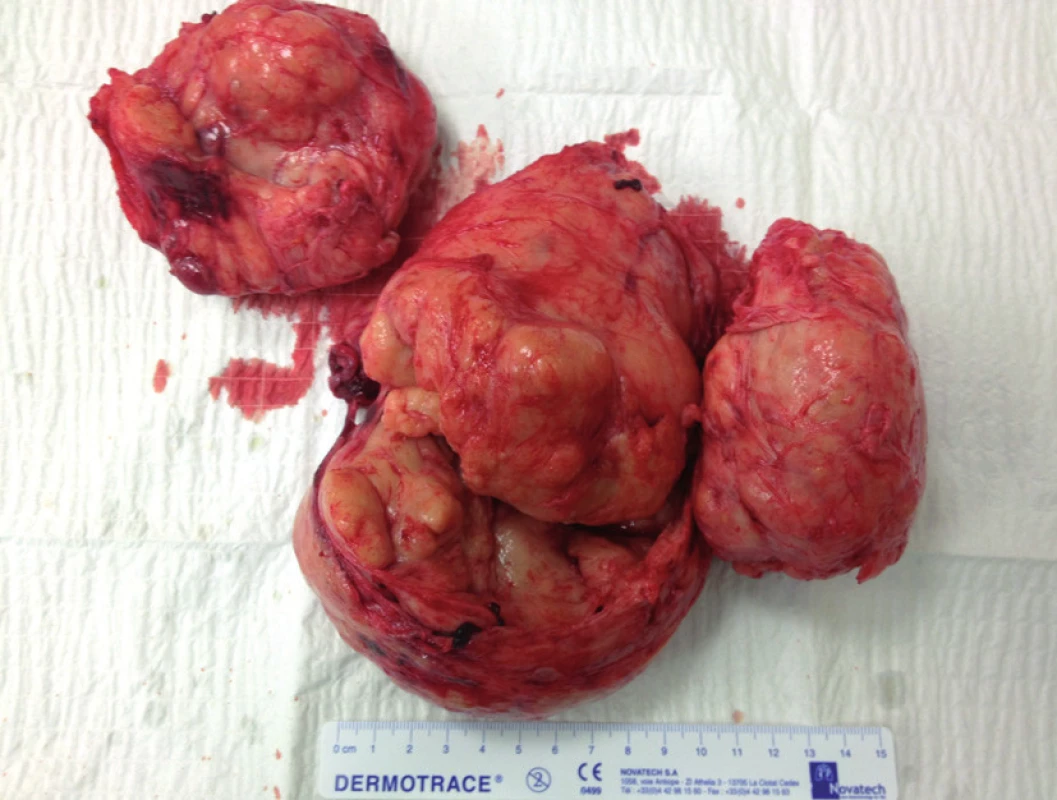 Definitivní preparát
Fig. 2. Final histological specimen