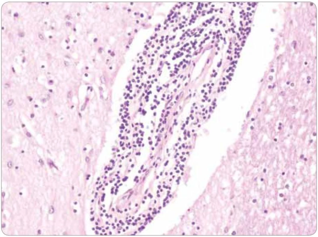 Základní barvení hematoxylin-eozin, zvětšení 200×.