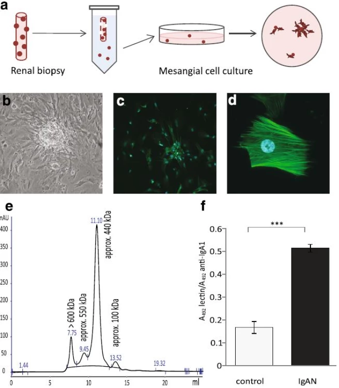 Mesangial cells were cultured from renal biopsies, characterized and treated with IgA. Schematic figure of harvest and culture of mesangial cells (a). Mesangial cells growing out from glomeruli (b). Immunofluorescence microscopy of smooth muscle actin labeling in mesangial cells. Smooth muscle actin is exclusively localized to the mesangial cells in the glomeruli. Mesangial cells cultured from glomeruli from renal biopsies were stained using an anti-smooth muscle actin antibody (<i>green</i>). Nuclei are stained <i>blue</i> with DAPI. Magnification 20× (c), 40× (d). The mesangial cells were negative for endothelial and podocyte markers, see Methods. IgA1 purified from human blood was run on HPLC to detect different sizes of IgA1 (e). A representative sandwich ELISA shows that IgA1 purified from patients with IgAN have a higher amount of gd-IgA than IgA1 purified from controls (f)