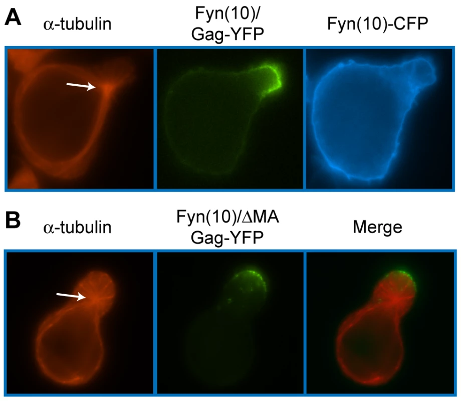 The MA sequence is not required for Gag localization to the uropod.