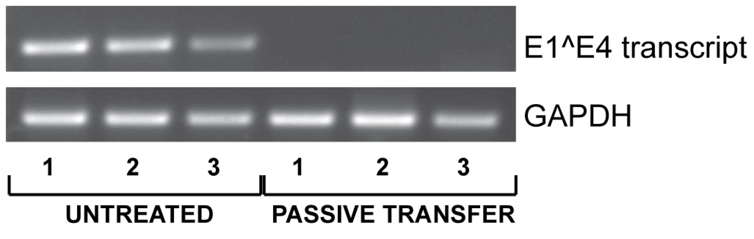 Inhibition of virus infection by passive immunization.