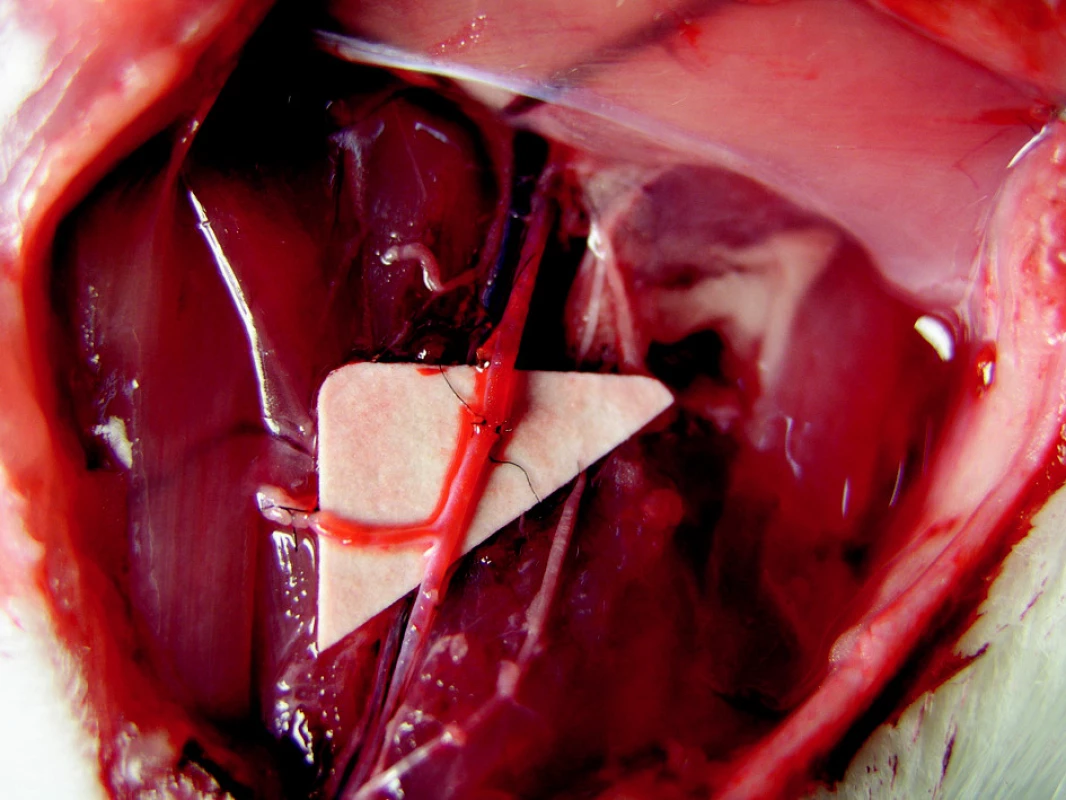 Anastomosis in nifedipine group