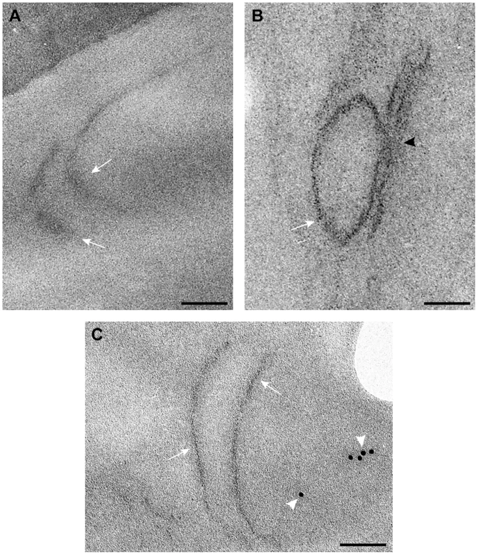 Detection of MT-tagged p33 replication protein in wild type and <i>vps4Δ</i> yeast.