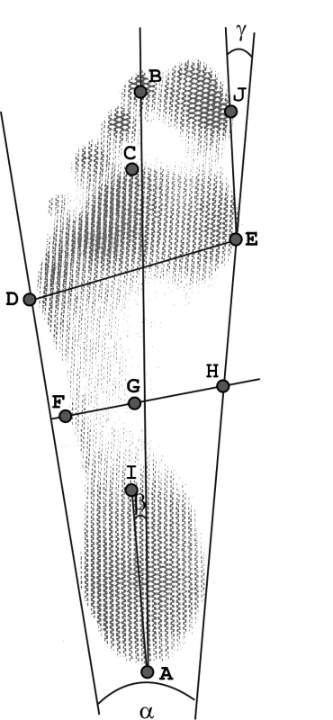 Morfologické body označované na chodidle a základní úhlové a délkové parametry.
Legenda: A – nejproximálněji položený bod, střed druhého prstu, nejdistálněji položený bod předonoží, D – nejlaterálněji položený bod předonoží, E – nejmediálnější bod přednoží na hlavičce I. metatarzu, F – laterálně položený bod v nejužším místě středonoží kolmém na laterální tečnu nohy, G – mediálně položený bod v nejužším místě středonoží kolmém na laterální tečnu nohy, H – průsečík kolmice v nejužším místě středonoží a mediální tečny nohy, I – nejdistálněji položený bod zánoží, J – nejmediálněji položený bod na palci, α – úhel nohy, β – úhel paty, γ – úhel palce (kladná hodnota úhlu signalizuje valgózní postavení palce, záporná virózní), |AC| - délka nohy bez prstů, |DE| - nejširší místo nohy, |FG| - nejužší místo nohy.