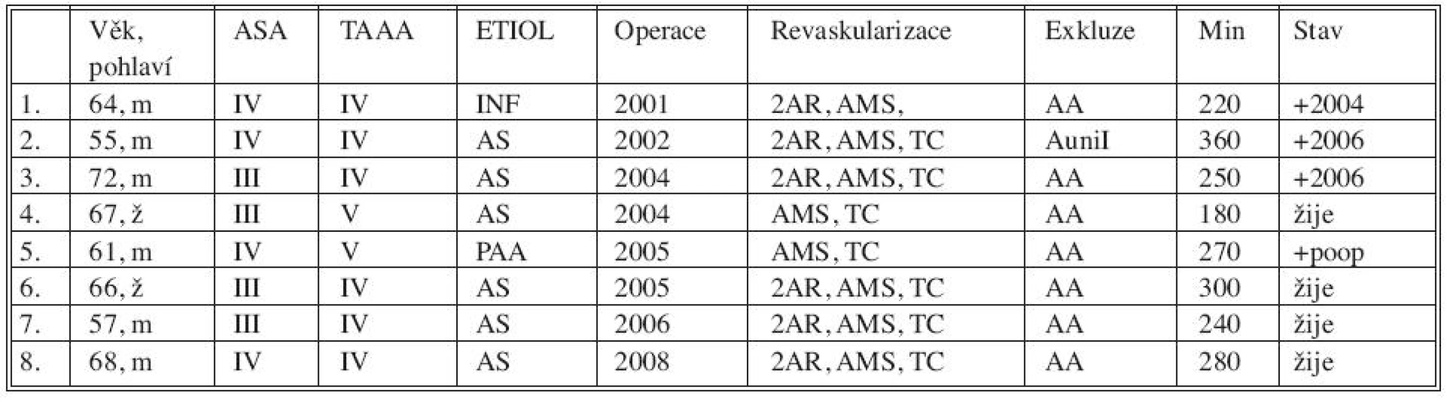 Sestava nemocných s TAAA IV, V léčených hybridním výkonem
Tab. 1. Group of patients with TAAA IV, V treated using the hybrid procedure