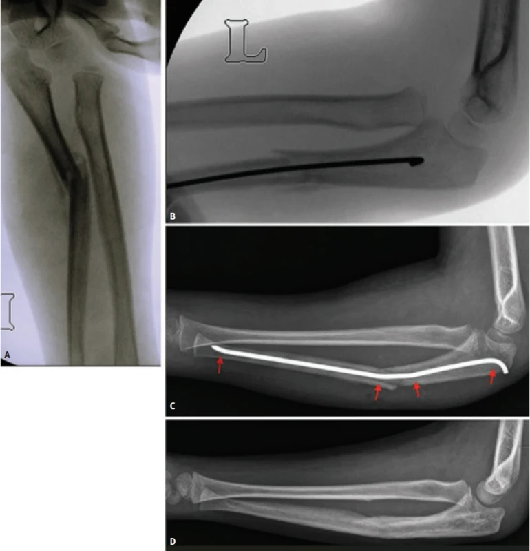  / Fig. 4.