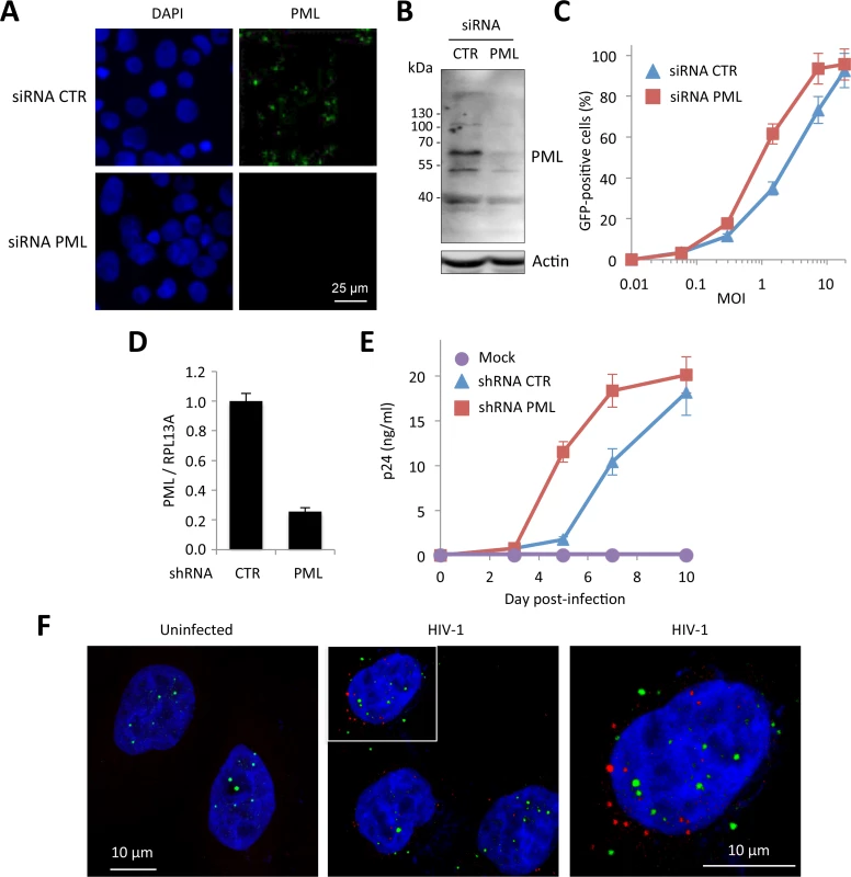 PML expression in human cells interferes with HIV infection.