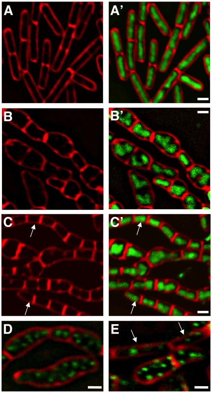 Δ<i>manA</i> phenotype is partially suppressed by slowing growth and replication.