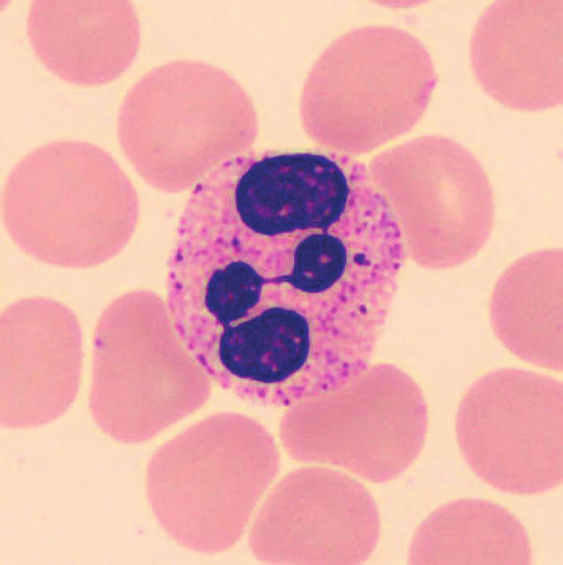 Neutrofilní segment (20 minut po odběru, laboratorní teplota)