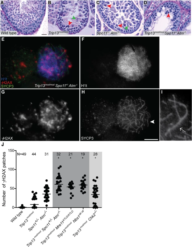 <i>Trip13</i><sup><i>mod/mod</i></sup> <i>Spo11</i><sup><i>+/−</i></sup> <i>Atm</i><sup>−/−</sup> spermatocytes arrest at epithelial stage IV, but present autosomal asynapsis, multiple unrepaired DSBs and fail to form a sex body at mid/late pachynema.