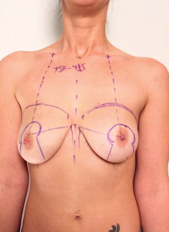 Patient before the operation
