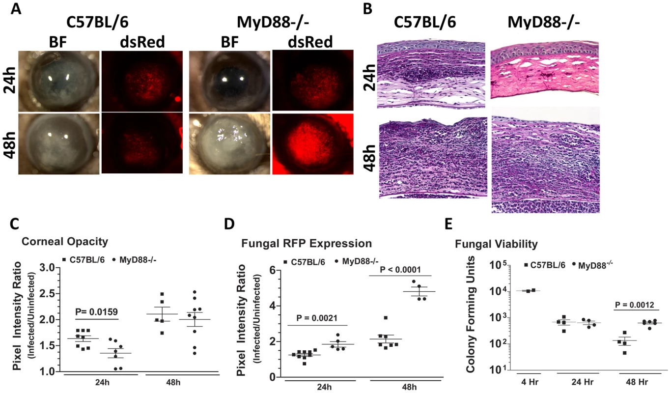 The role of MyD88 in <i>A. fumigatus</i> keratitis.