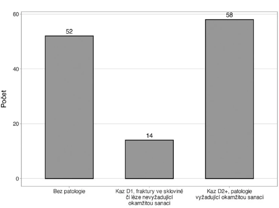 Výskyt vad v souboru pacientů (n = 124). Fig. 2 Prevalence of defects in the patient sample (n = 124).