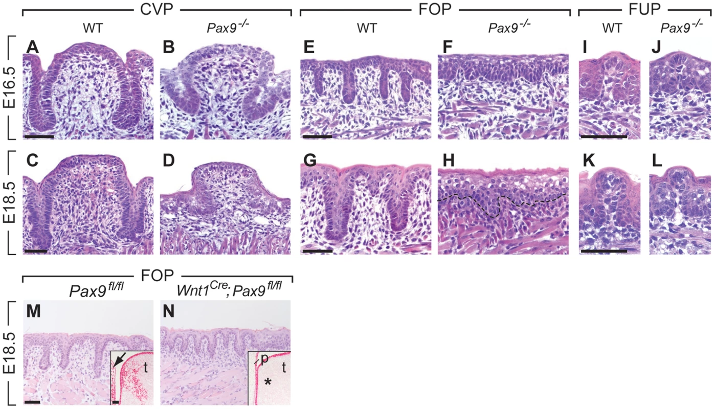 Arrest of CVP and FOP development in <i>Pax9</i>-deficient mouse embryos.