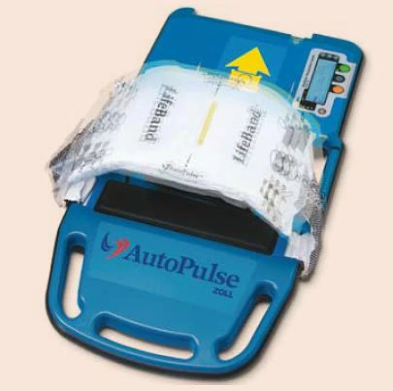 AutoPulse® [103].