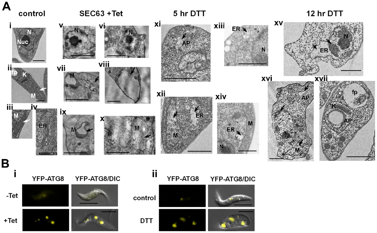 TEM of SLS-induced cells demonstrating morphological changes characteristic of apoptosis.