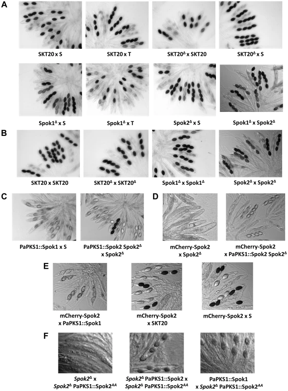 Rosettes of asci in indicated crosses.