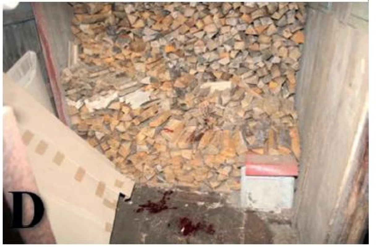 <b>A:</b> Makroskopické foto znázorňujíc vztahy mezi tělem a pozadím s krevnými stopy. <b>B:</b> Pohled na zbraň na zemi. <b>C:</b> Pohled na židli s roztrhnutým povlakem. Povšimněte si prosím krevní stopy v pozadí a na zemi. <b>D:</b> Pohled na dlažbu a pozadí s dobře viditelnými krevními stopami.
